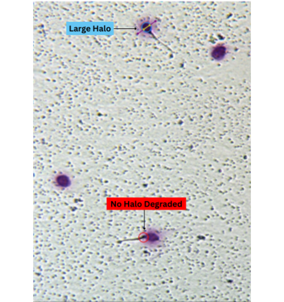 dna fragmentation sperm image 
