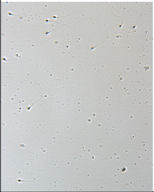 sperm under microscope