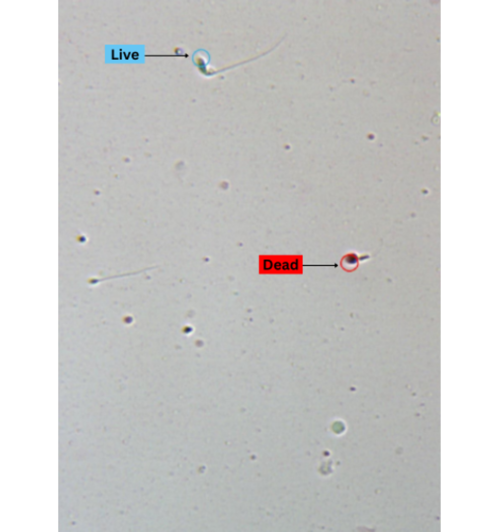 Live and Dead sperm vitality test illustration